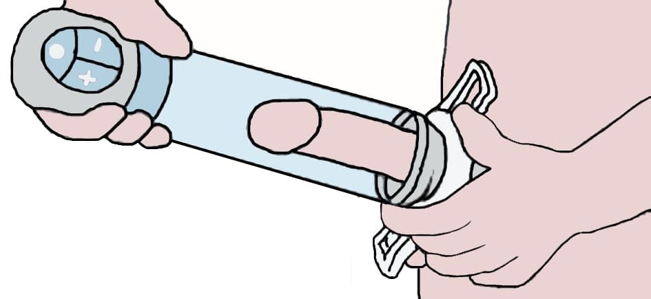 pompe-a-penis-1095395
